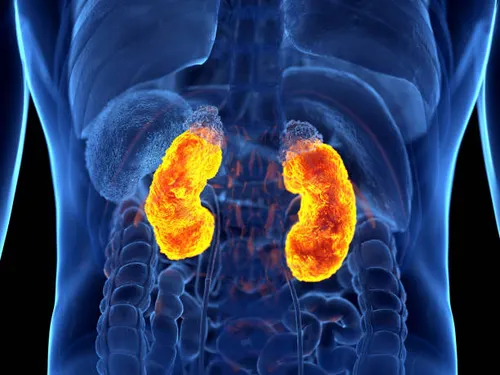 kidney cancer illustration